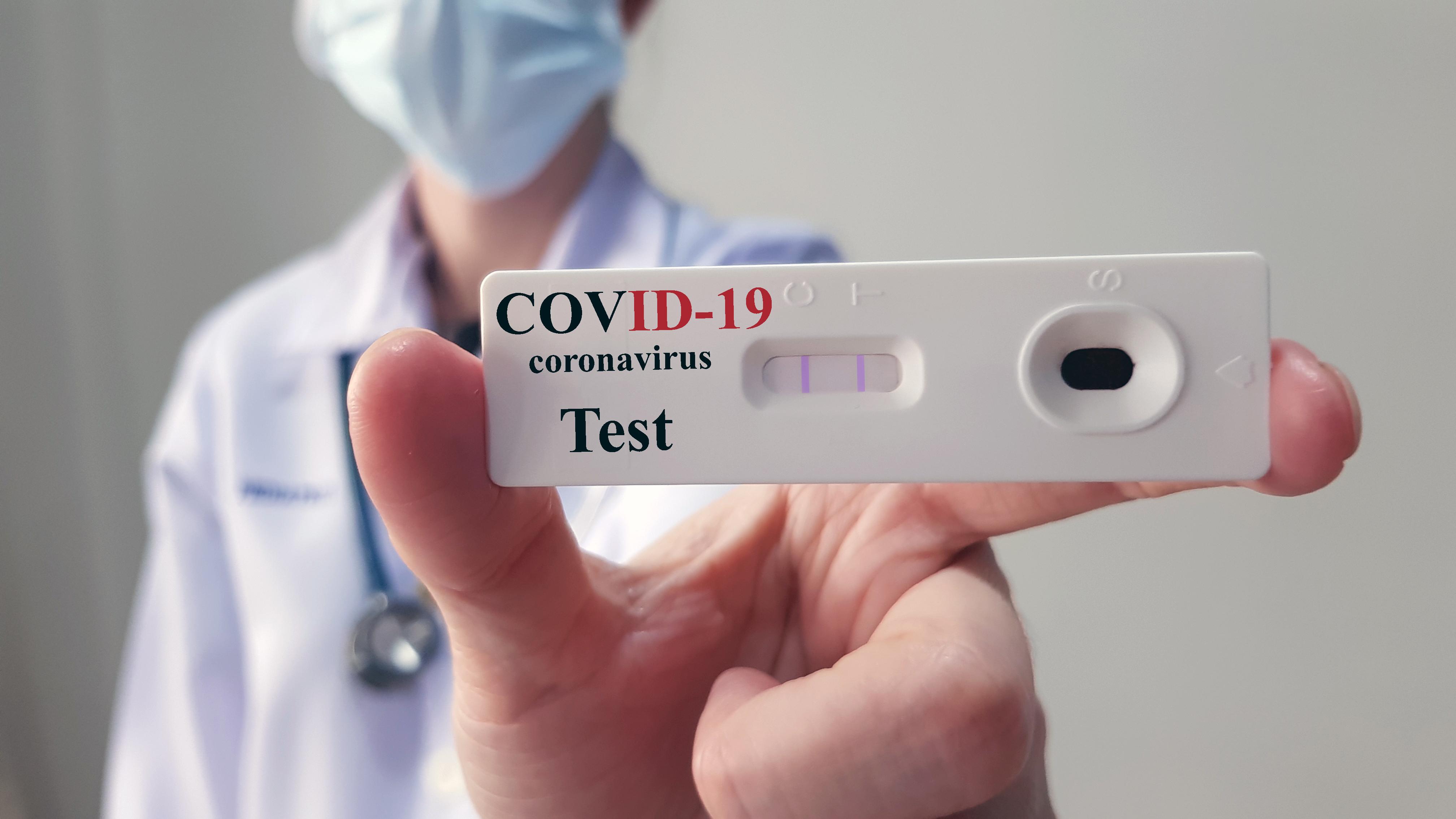 Caixa disponibiliza testes para Covid-19 a todos funcionários